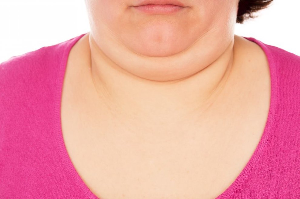 How To Lose Neck Fat 990×657