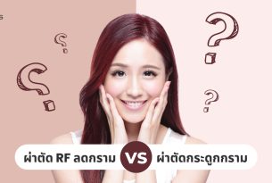 ผ่าตัด RFกล้ามเนื้อกราม VS ผ่าตัดกระดูกกราม