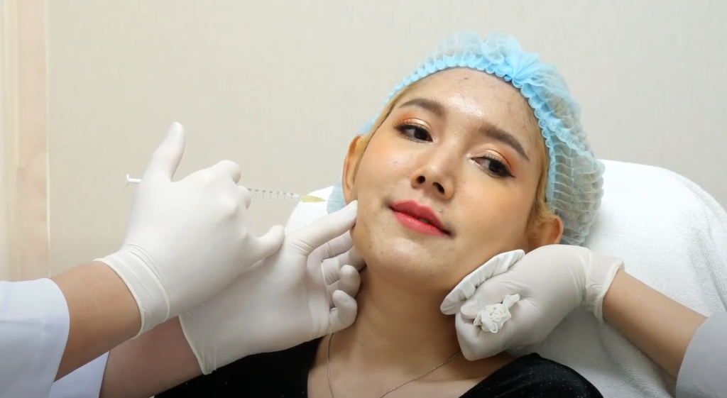 Botox ลดกราม Hersclinic