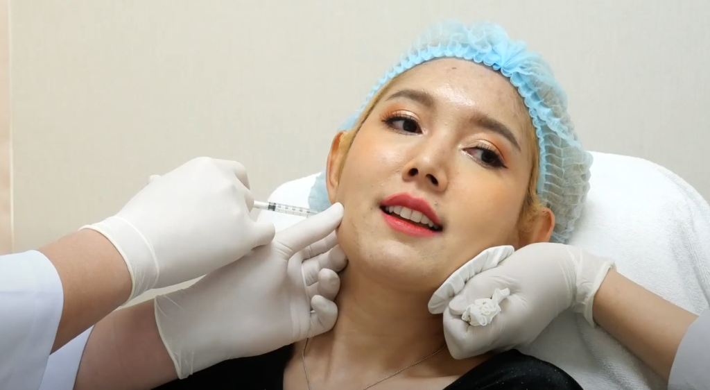 Botox ลดกราม Hersclinic