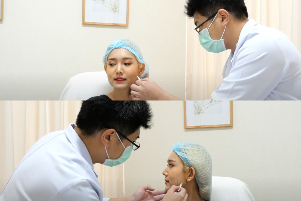 Botox ลดกราม Hersclinic