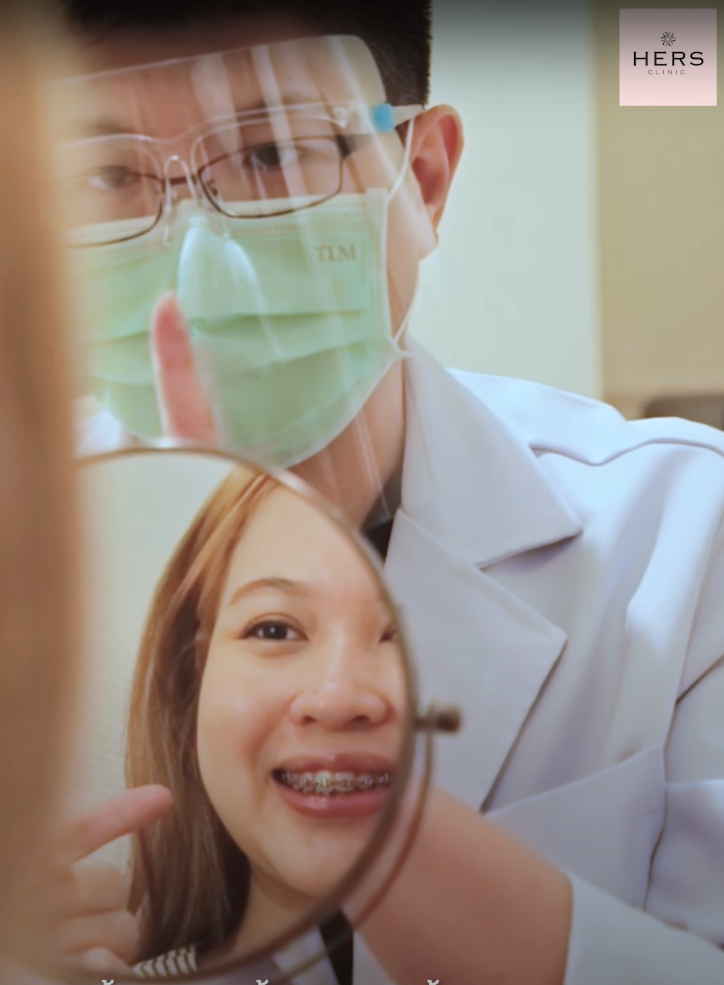 ตัดไขมันกระพุ้งแก้ม Hers clinic