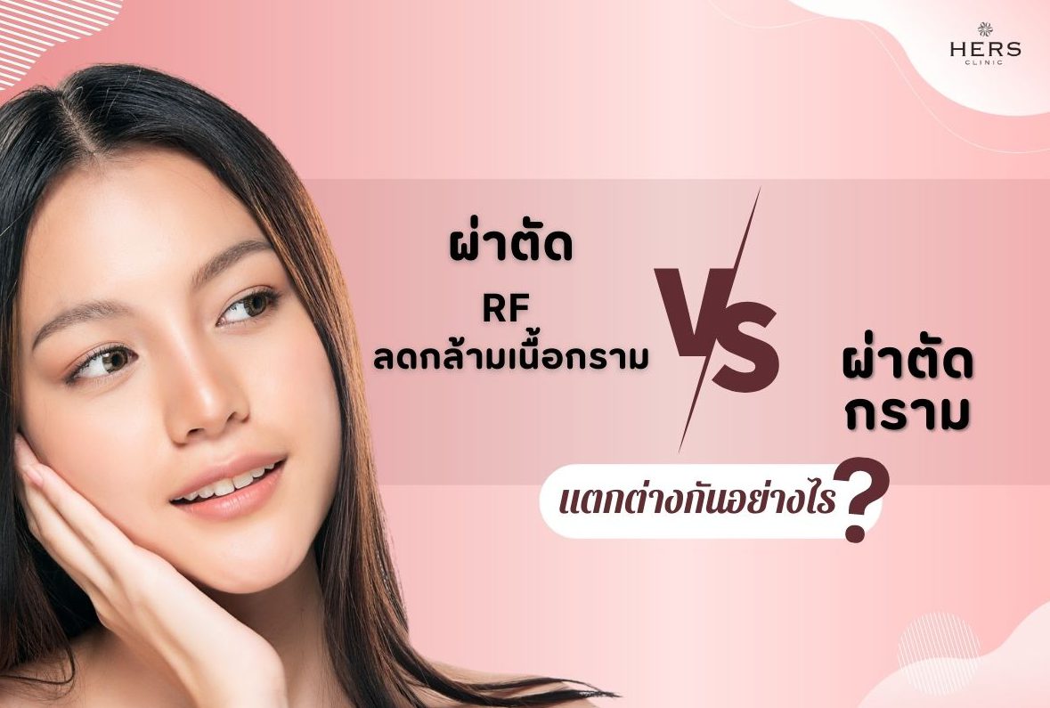 ผ่าตัด RF กราม VS ตัดกราม