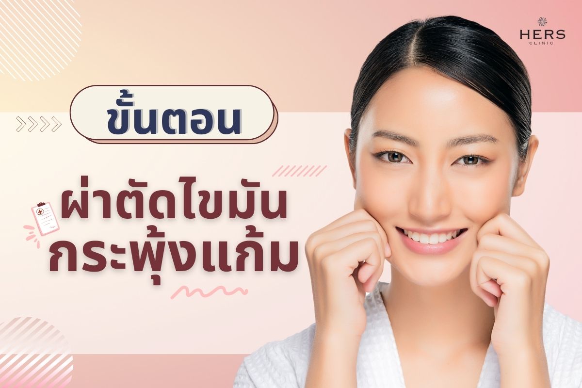 ขั้นตอน การผ่าตัดไขมันกระพุ้งแก้ม