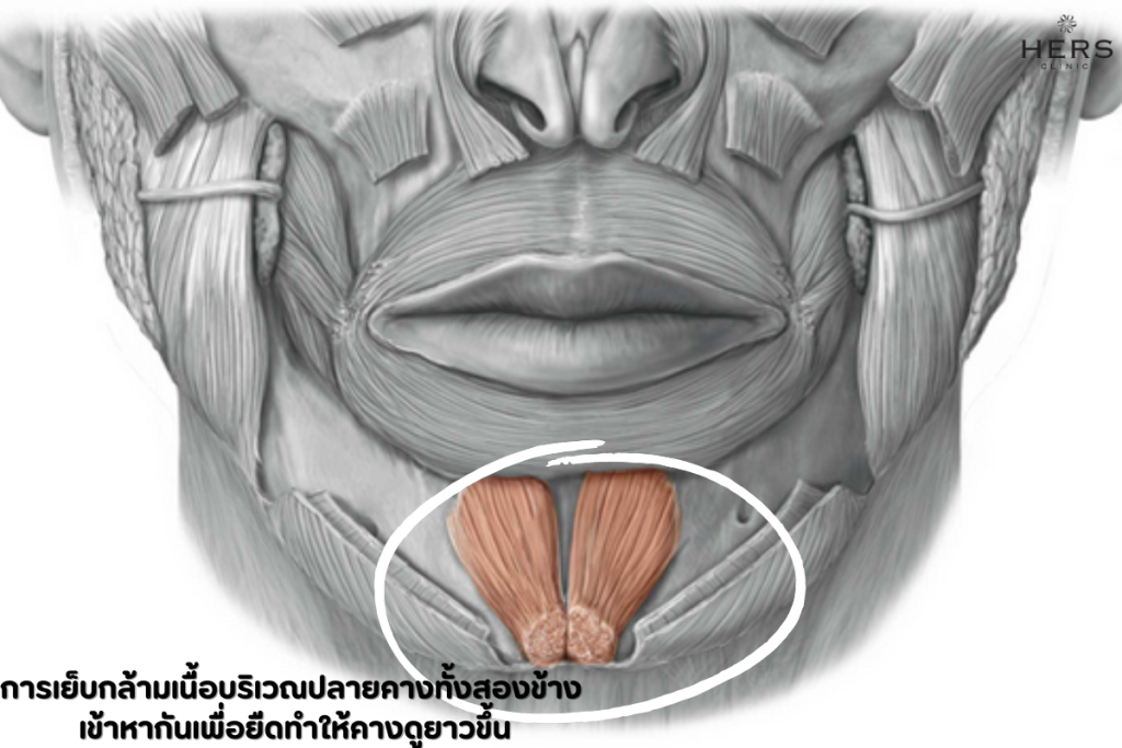 ดูรูปทรงเรียวเป็นวีเชฟมากขึ้น