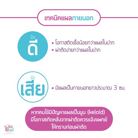 ขึ้นกับโครงสร้างของคางของแต่ละบุคคล