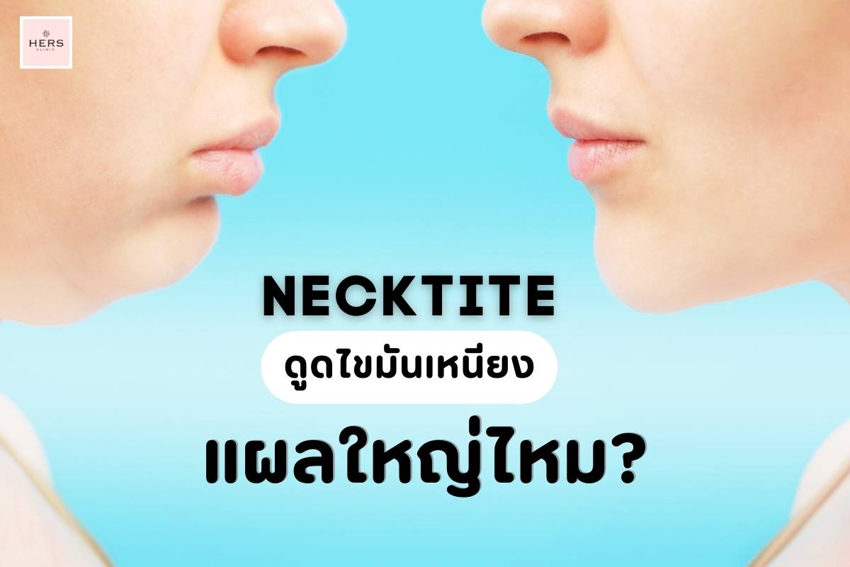 Necktite ดูดไขมันเหนียง แผลใหญ่ไหม