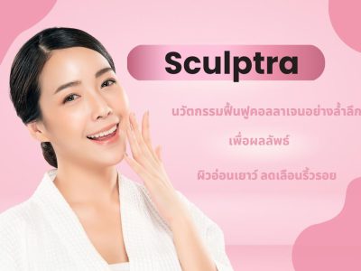 ทำความรู้จัก Sculptra