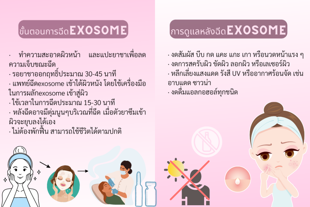 ดูแลตนเองหลังฉีด Exosome